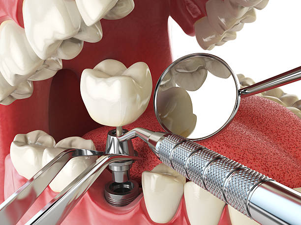 Best Broken or Cracked Tooth Emergency Dentist in Mayer, AZ